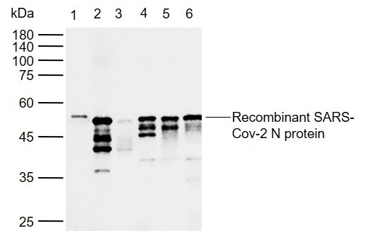 Anti-SARS-CoV-2 (2019-nCoV) Nucleocapsid Antibody (2Q299)