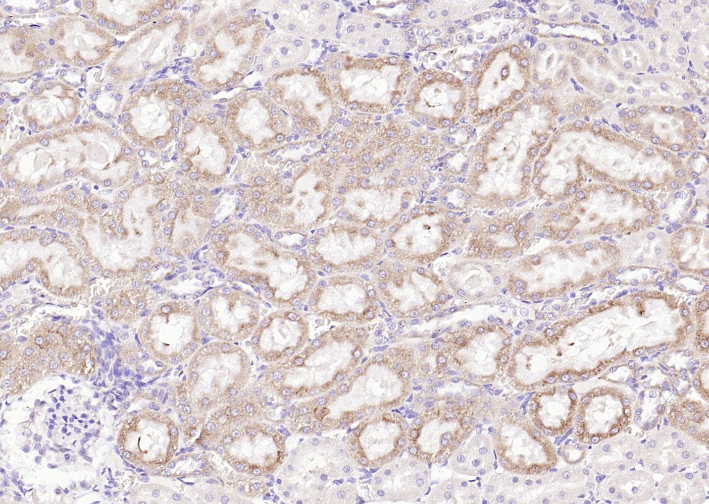 Anti-PI3 Kinase Class 3 Polyclonal Antibody