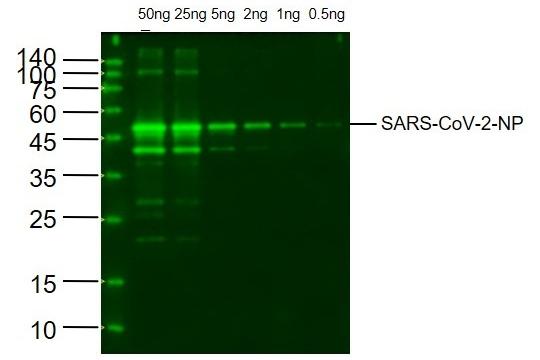 Anti-SARS-CoV-2 (2019-nCoV) Nucleocapsid Antibody (1Z747)
