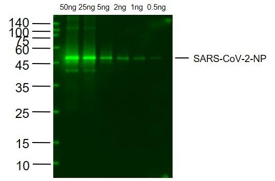 Anti-SARS-CoV-2 (2019-nCoV) Nucleocapsid Antibody (2Q299)