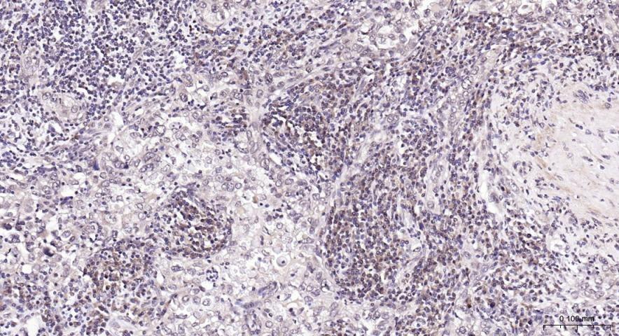 Anti-PI3Kβ Polyclonal Antibody