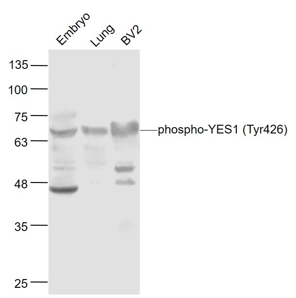 Anti-Phospho-YES1 (Tyr426) Polyclonal Antibody