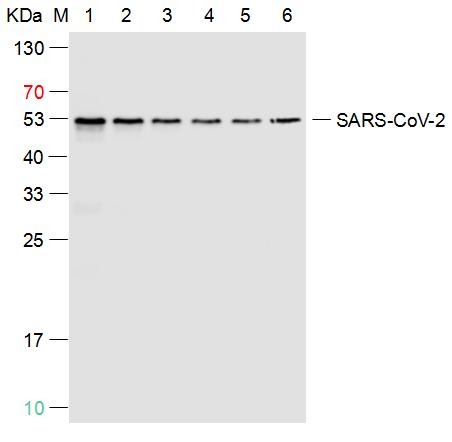 Anti-SARS-CoV-2 (2019-nCoV) Nucleocapsid Antibody (1Z747)