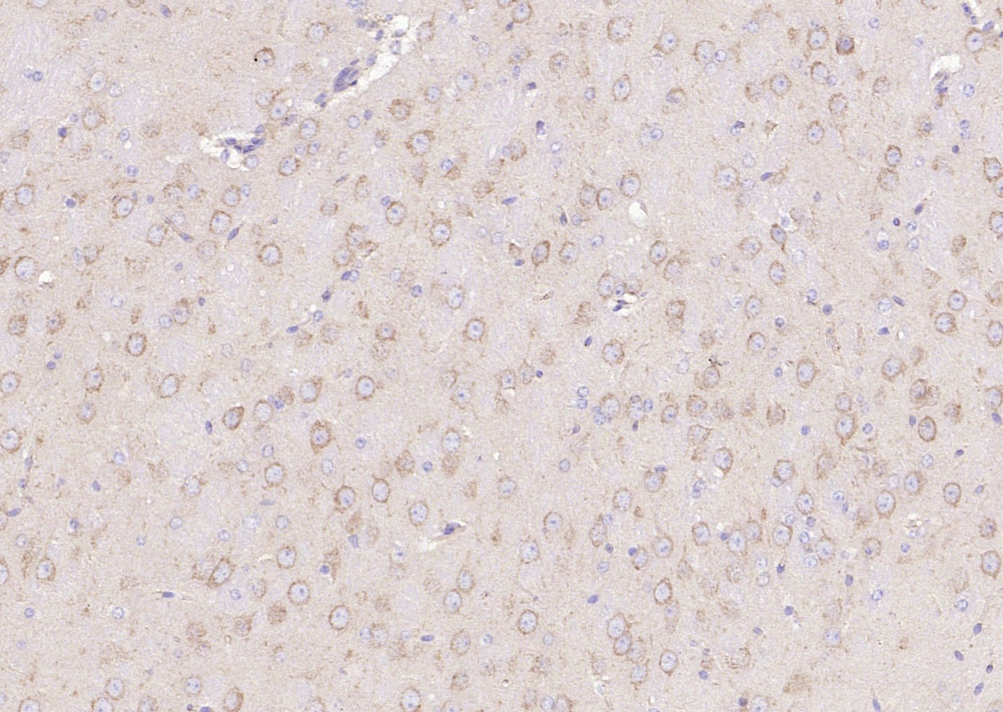 Anti-PI3 Kinase Class 3 Polyclonal Antibody