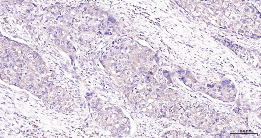 Anti-PI3Kβ Polyclonal Antibody