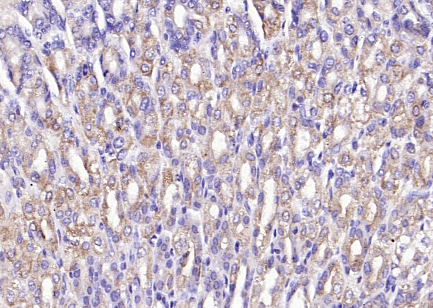Anti-PI3 Kinase Class 3 Polyclonal Antibody