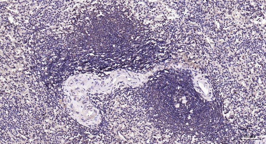 Anti-PI3Kβ Polyclonal Antibody