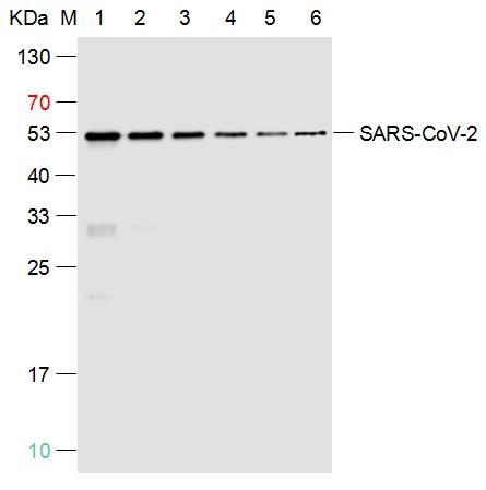 Anti-SARS-CoV-2 (2019-nCoV) Nucleocapsid Antibody (5C944)