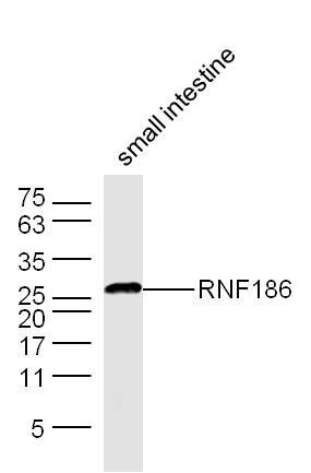 Anti-RNF186 Polyclonal Antibody