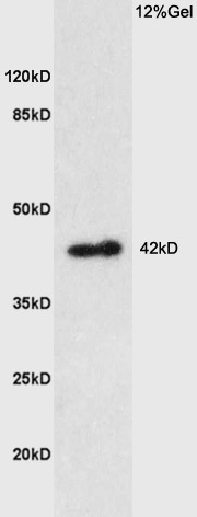 Anti-PTGER1 Polyclonal Antibody