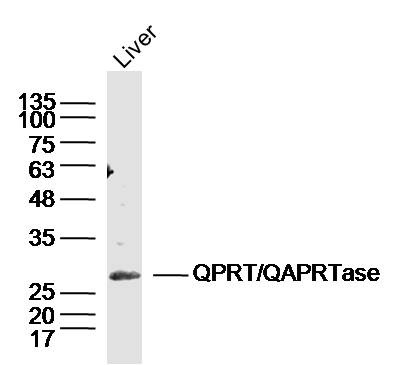 Anti-QPRTase Polyclonal Antibody