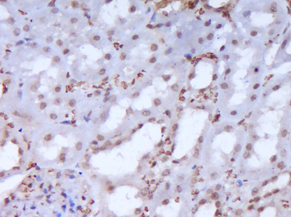 Anti-RORC Polyclonal Antibody