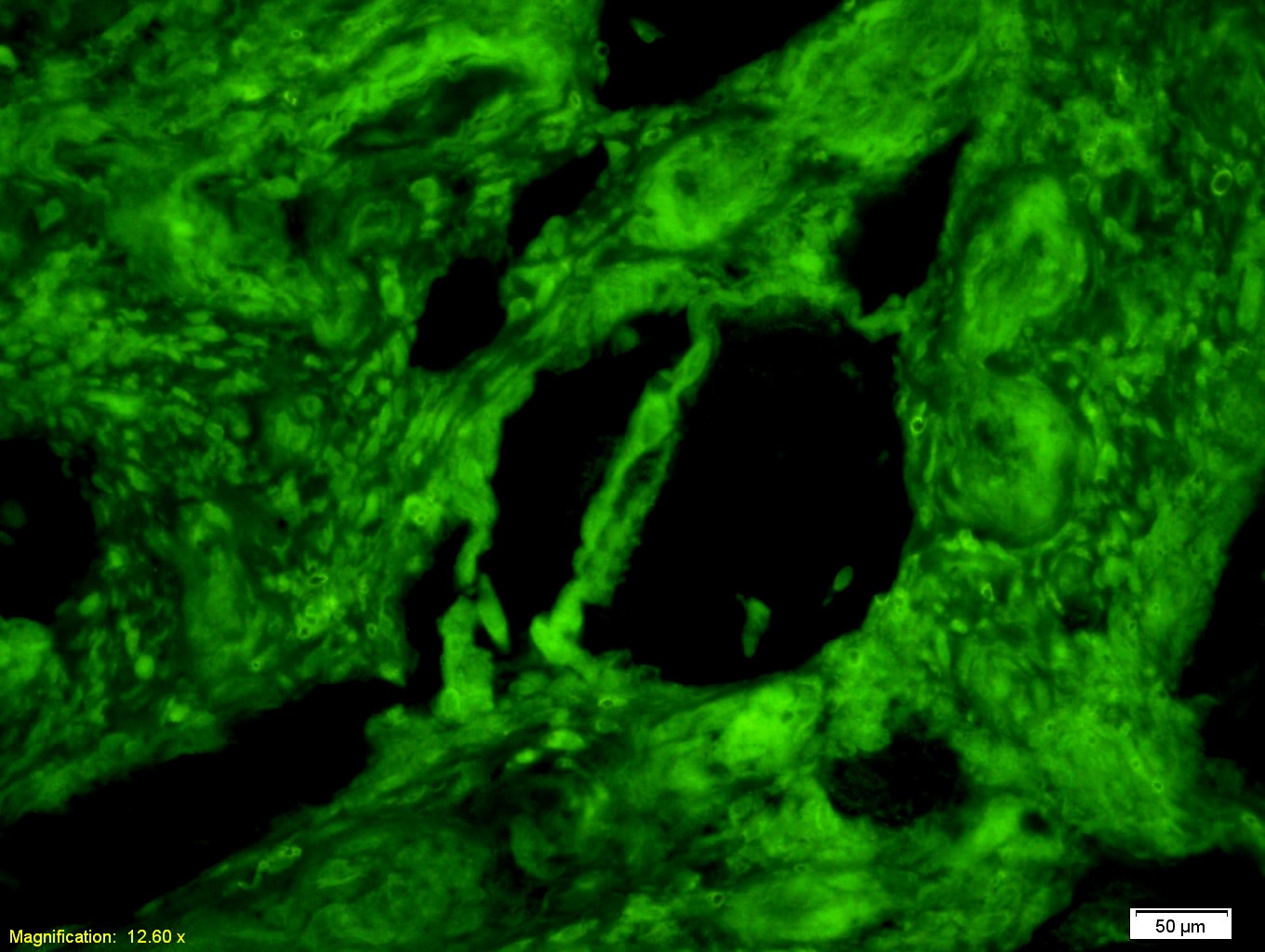 Anti-PKM2 Polyclonal Antibody 2