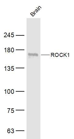 Anti-ROCK1 Polyclonal Antibody