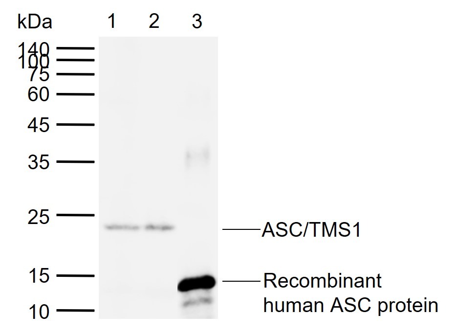 Anti-PYCARD Polyclonal Antibody 2