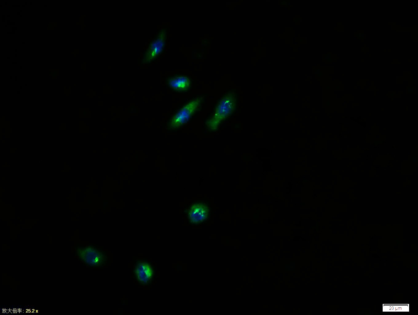 Anti-PIK3R1 Polyclonal Antibody