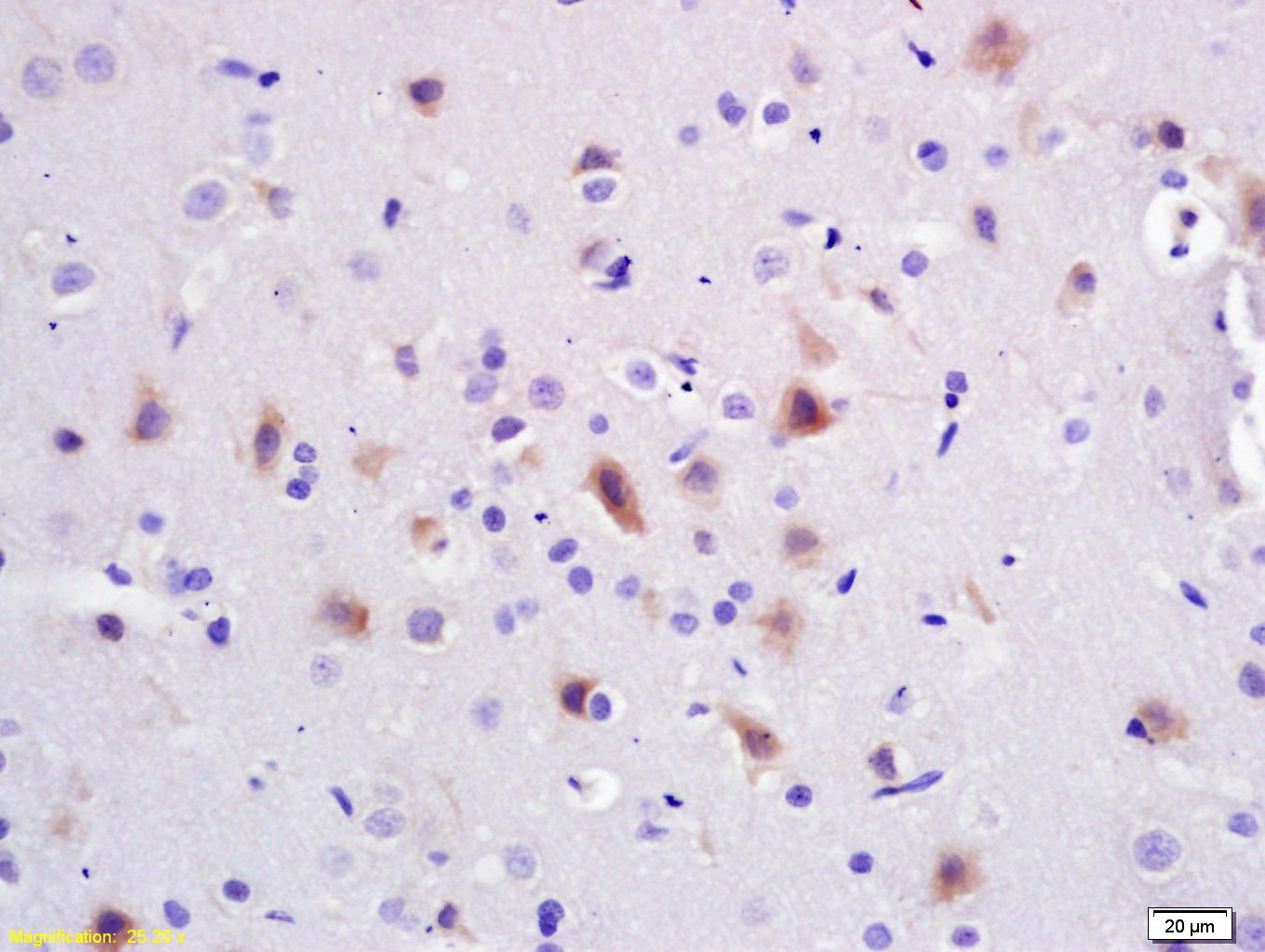Anti-PIK3R1 Polyclonal Antibody