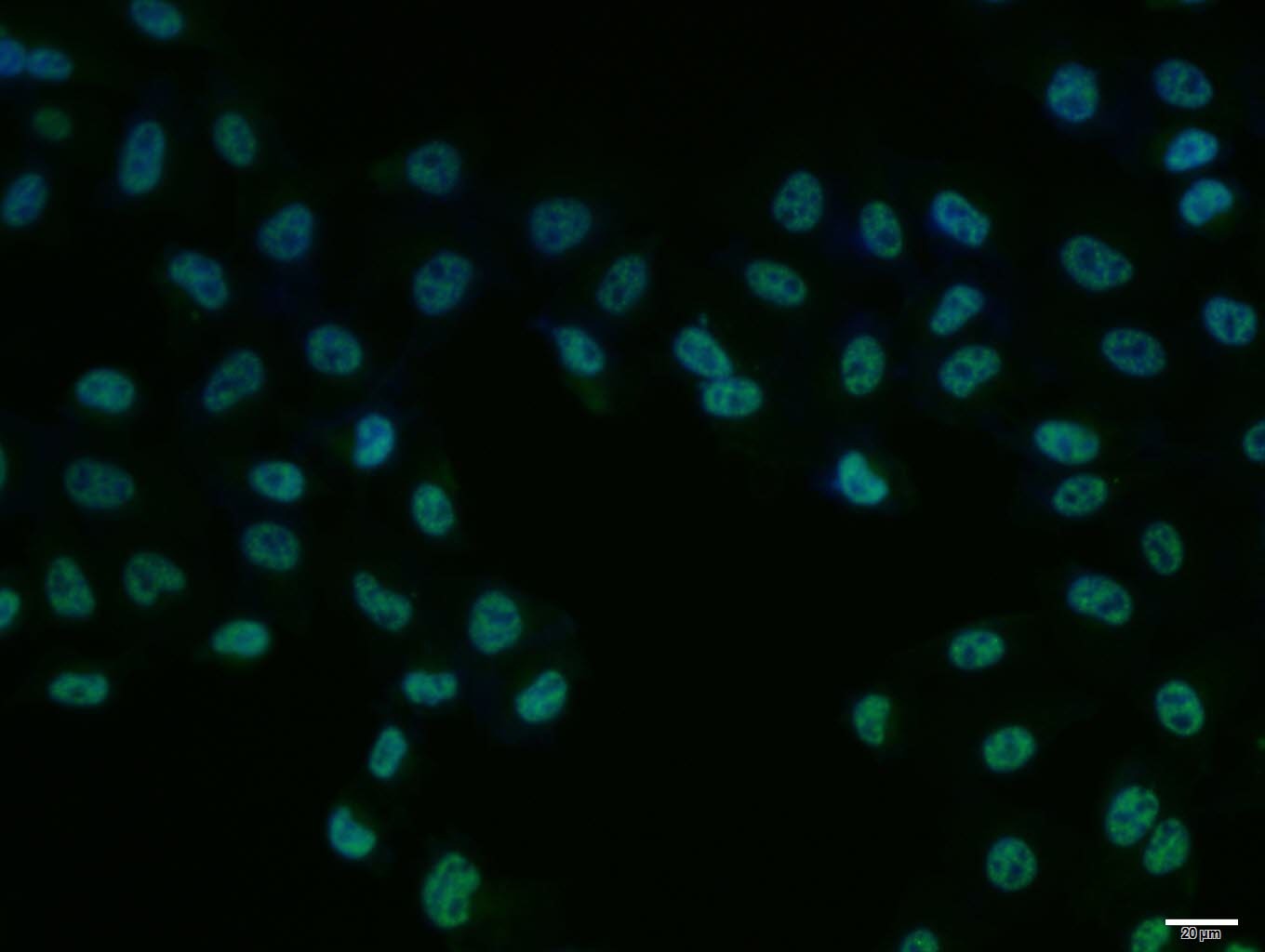 Anti-PKM2 Polyclonal Antibody