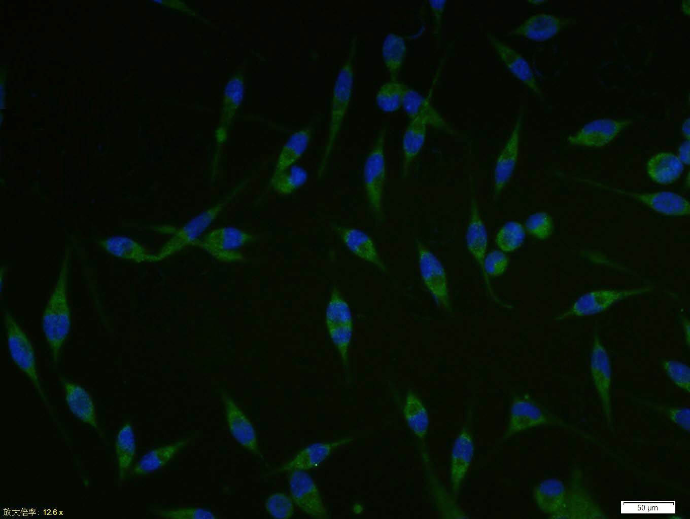 Anti-SCD1 Polyclonal Antibody