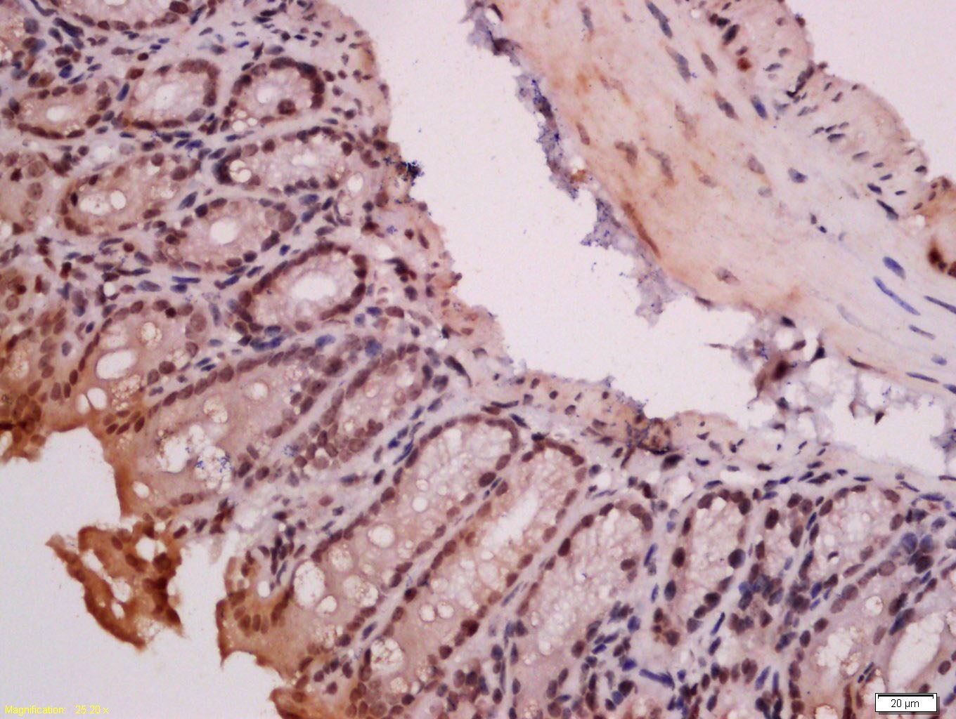 Anti-RORC Polyclonal Antibody 2