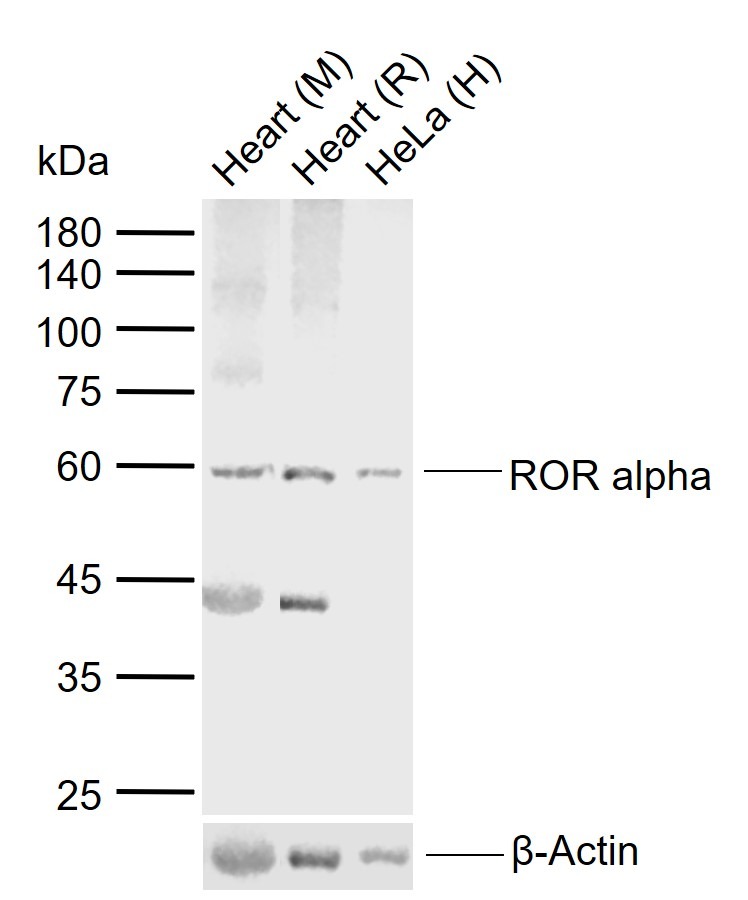 Anti-ROR alpha Polyclonal Antibody