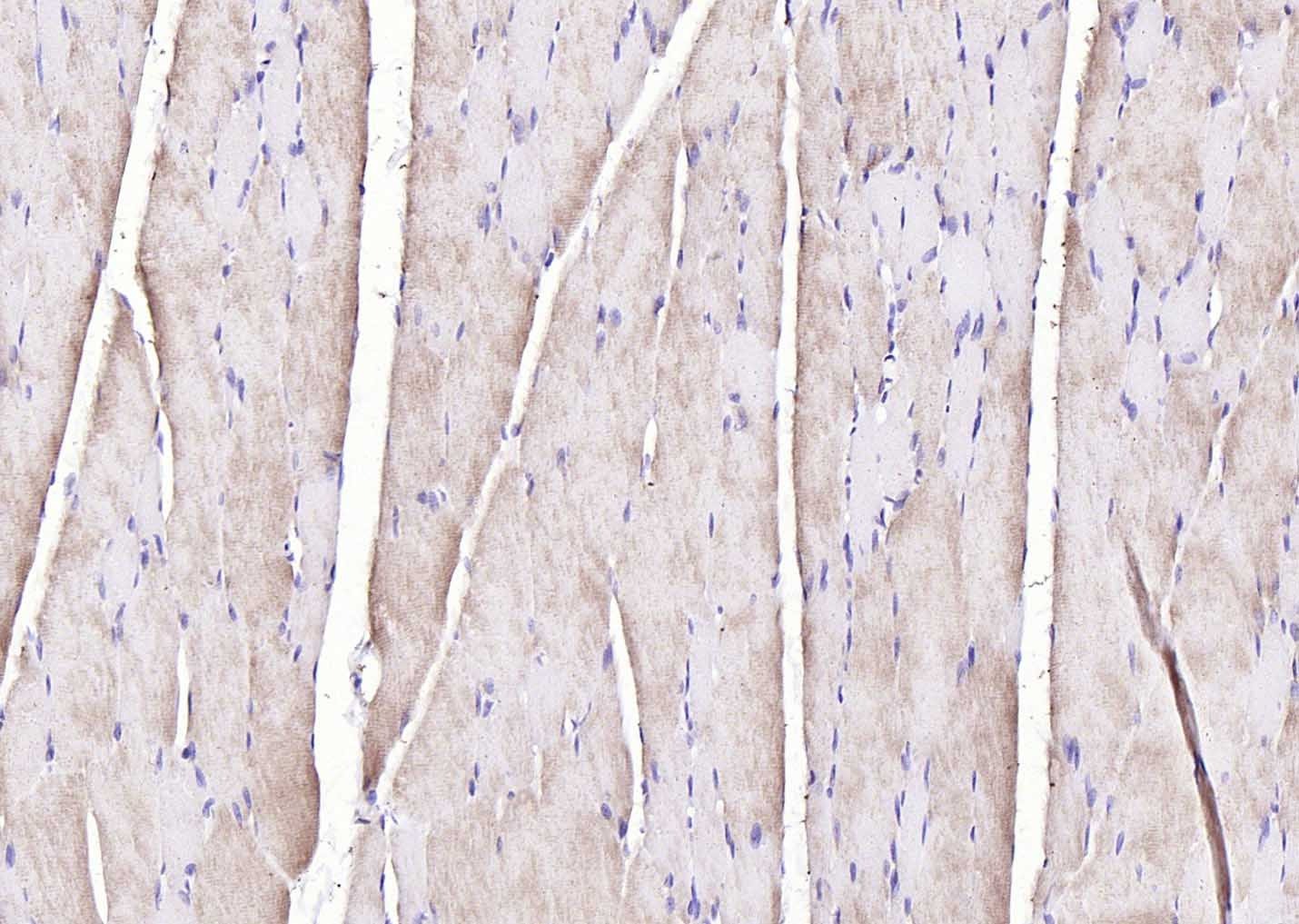 Anti-PYGM Polyclonal Antibody