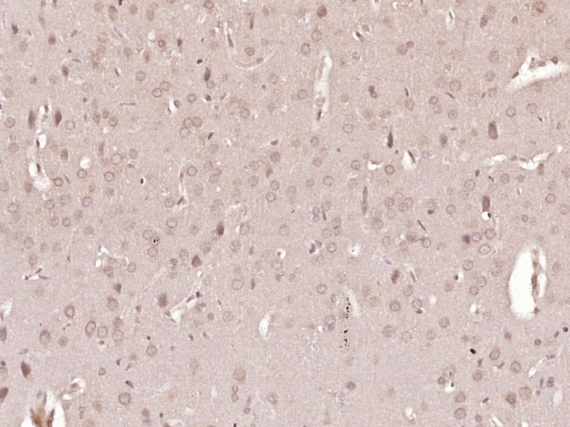 Anti-PIK3CA Polyclonal Antibody