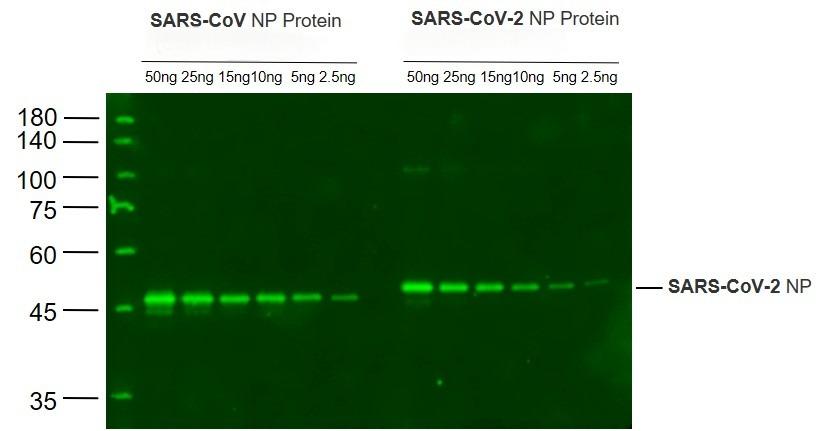 Anti-SARS-CoV-2 N Polyclonal Antibody