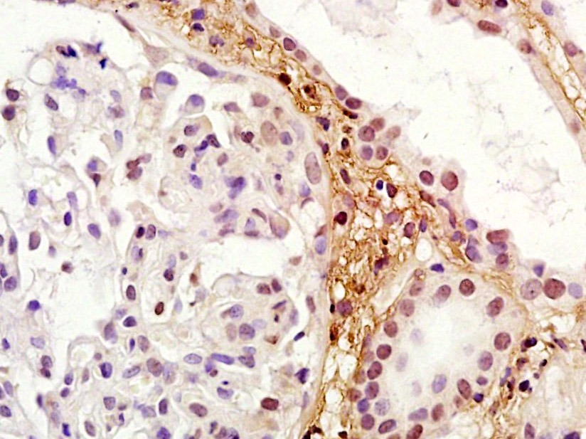 Anti-RORC Polyclonal Antibody 3
