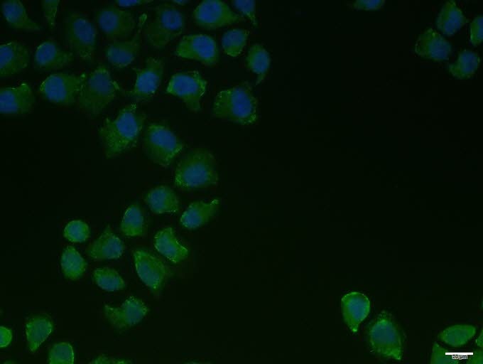 Anti-PIEZO1 Polyclonal Antibody