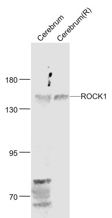 Anti-ROCK1 Polyclonal Antibody