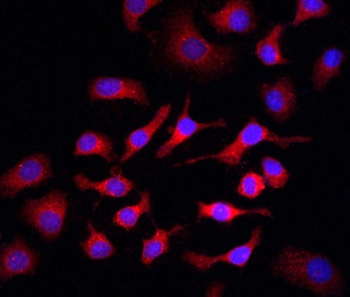 Anti-PIK3R1 Polyclonal Antibody