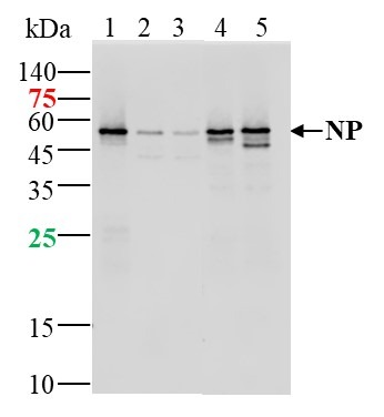 Anti-SARS-CoV-2 (2019-nCoV) Nucleocapsid,  WT & Ormicron Recognized Antibody (8M778)