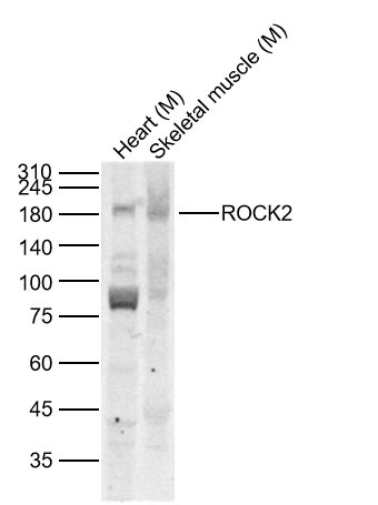 Anti-ROCK2 Polyclonal Antibody