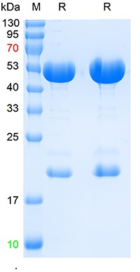 Anti-SARS-CoV-2 (2019-nCoV) Nucleocapsid, WT & Ormicron Recognized Antibody (6F930)