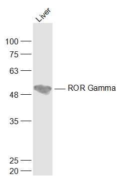 Anti-RORC Polyclonal Antibody 2