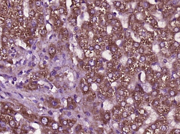 Anti-SCD1 Polyclonal Antibody