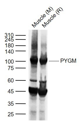 Anti-PYGM Polyclonal Antibody