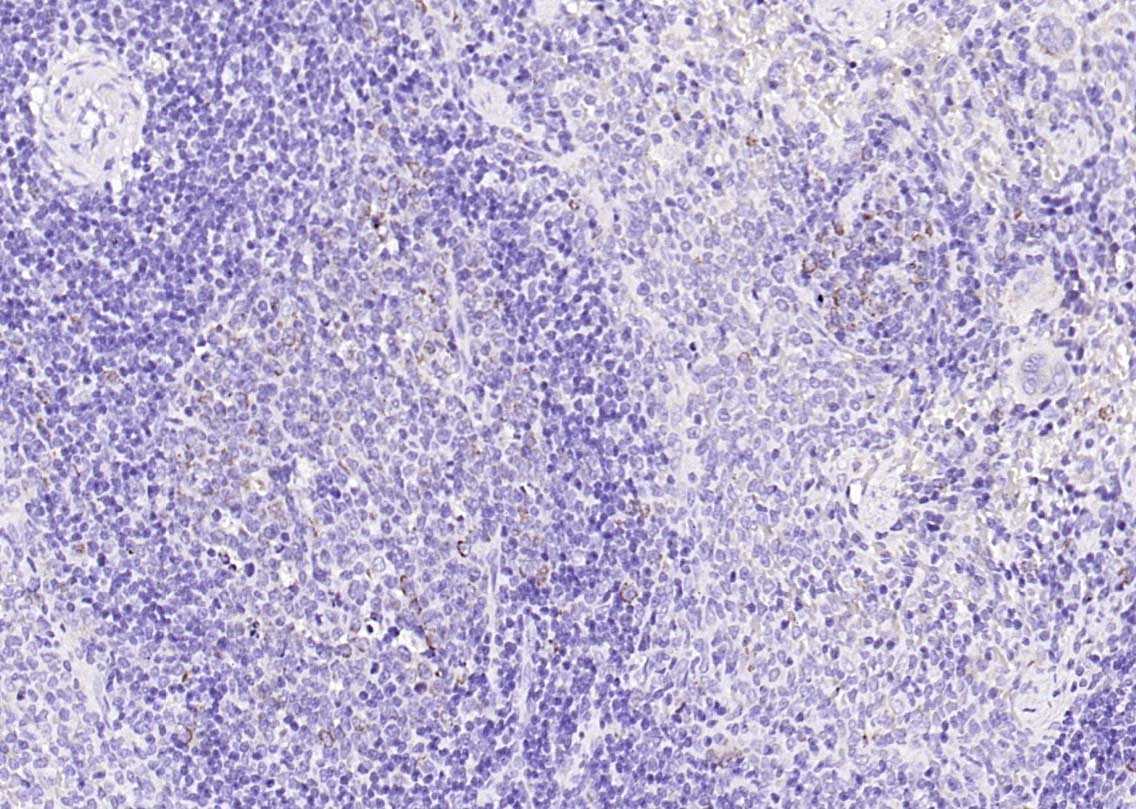 Anti-SCD1 Polyclonal Antibody