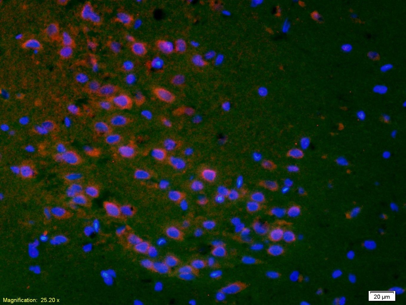 Anti-PTGER1 Polyclonal Antibody