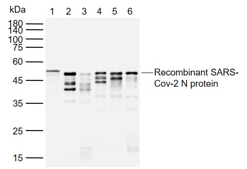 Anti-SARS-CoV-2 (2019-nCoV) Nucleocapsid,  WT & Ormicron Recognized Antibody (8M778)