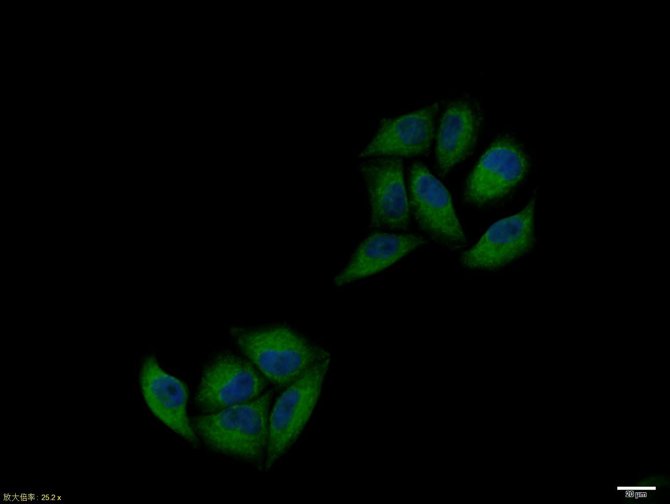 Anti-PKA alpha/beta Polyclonal Antibody