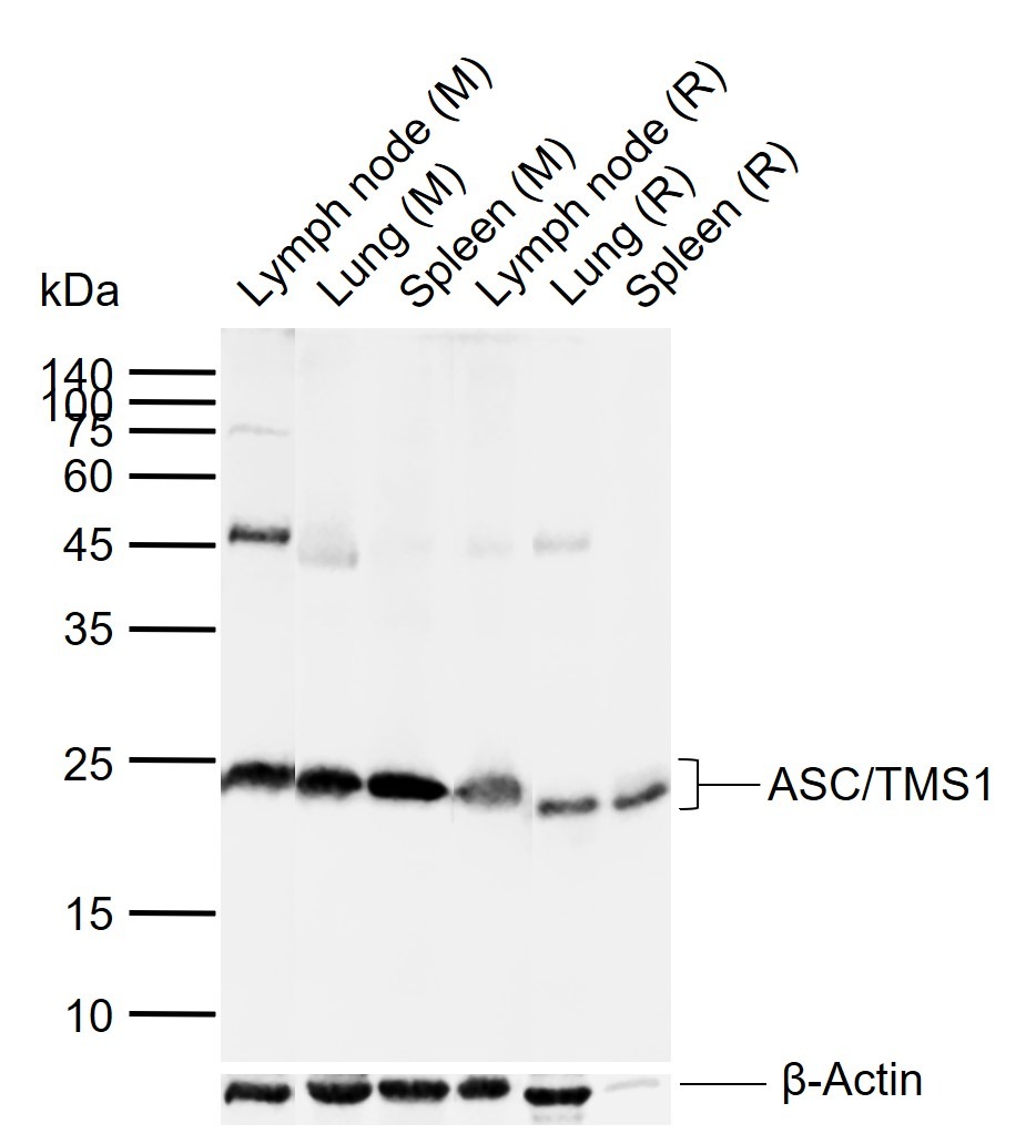 Anti-PYCARD Polyclonal Antibody 3