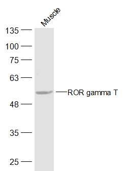 Anti-ROR gamma T Polyclonal Antibody 2