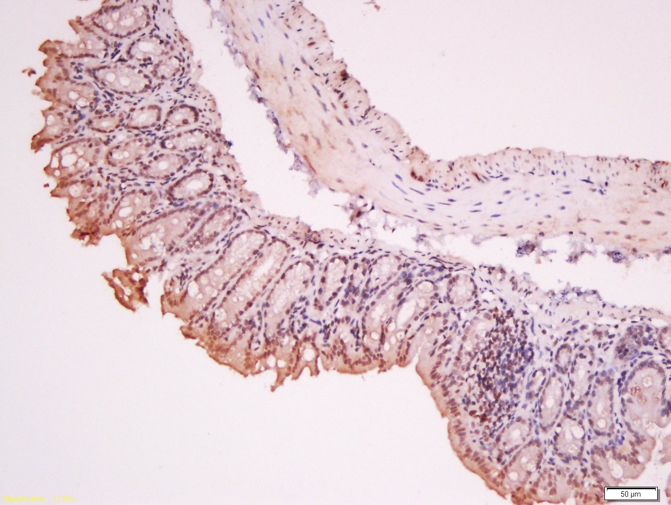 Anti-RORC Polyclonal Antibody 2
