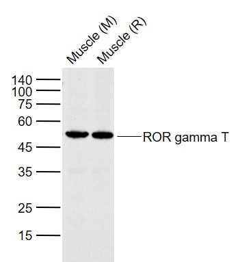 Anti-ROR gamma T Polyclonal Antibody