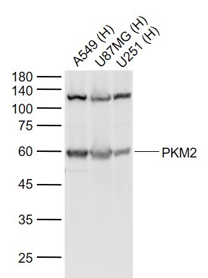 Anti-PKM2 Polyclonal Antibody