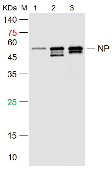 Anti-SARS-CoV-2 (2019-nCoV) Nucleocapsid, WT & Ormicron Recognized Antibody (6F930)