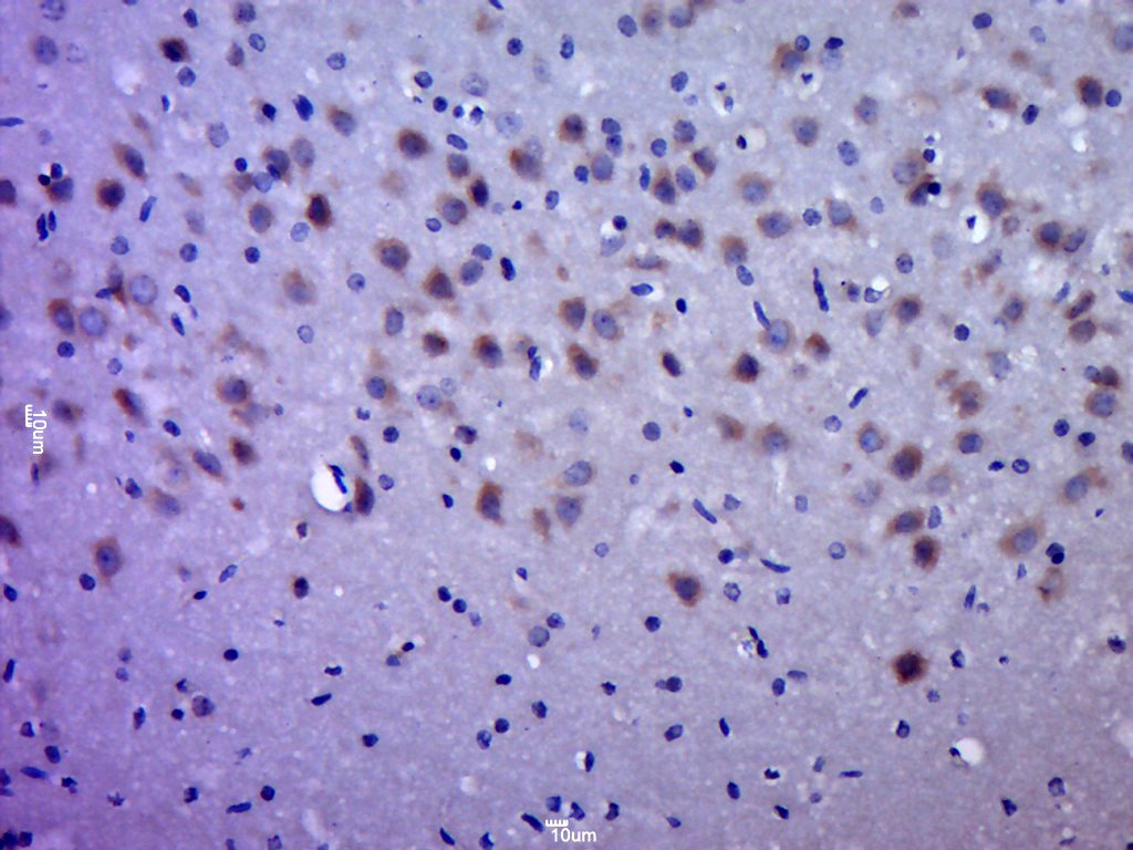 Anti-QPRTase Polyclonal Antibody