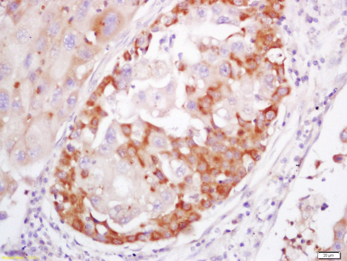 Anti-S100A4 Polyclonal Antibody